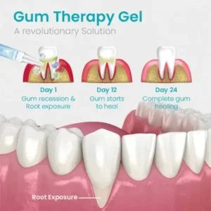 BBOJI™ Gum Shield Therapy Gel