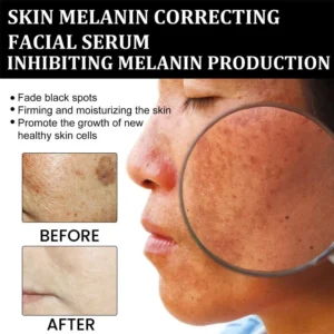 ADFIRE™ Melanin Correcting Facial Serum