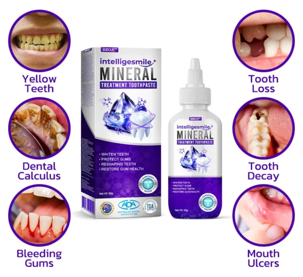 BBOJI™ IntelligeSmile Mineral Treatment Toothpaste