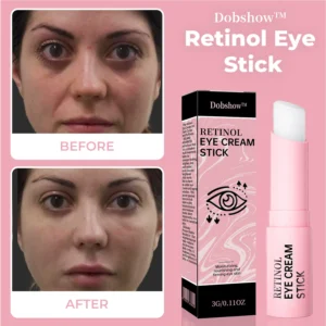 Dobshow™ Retinol Eye Cream Stick