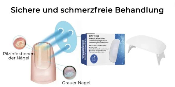 Fivfivgo™ Revolutionäres Lichttherapiegerät für Zehennagelkrankheiten