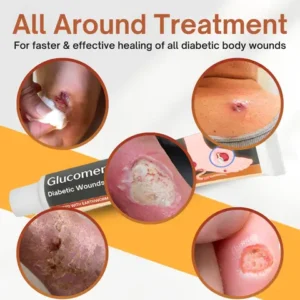 Glucomend™ Diabetic Wounds Treatment Cream