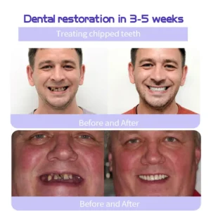 HZA Teeth Restoration Mineral Powder