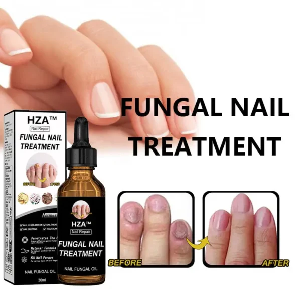 HZA™Fungal Nail Treatment