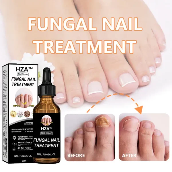 HZA™Fungal Nail Treatment