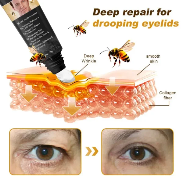 LENARO™ Bee Venom Awakening Peptide Eye Lifting Gel