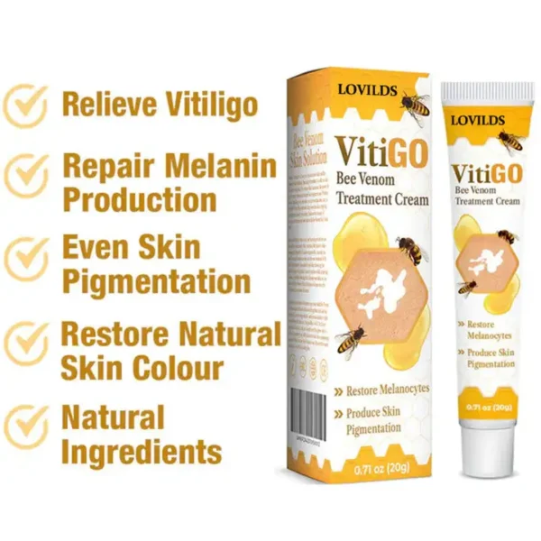 LOVILDS™ BeeVenom Vitiligo Treatment Cream