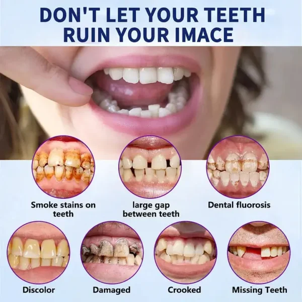 NESLEMY™-🦷Advanced Customized Full Denture Set🦷