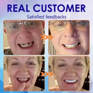 NESLEMY™-🦷Advanced Customized Full Denture Set🦷