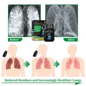 Ourlyard™ Herbal Lung Cleansing Inhaler