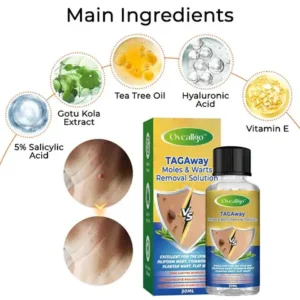 Oveallgo™ TAGAway Moles & Warts Removal Solution