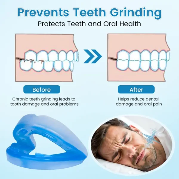 QIAWI ™ Anti-Snoring & Anti-Grinding Teeth Protector