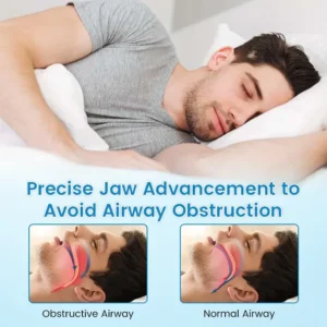 QIAWI ™ Anti-Snoring & Anti-Grinding Teeth Protector