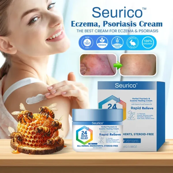 Seurico™ Eczema, Psoriasis Cream